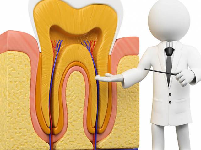 Root Canal Treatment in Antalya